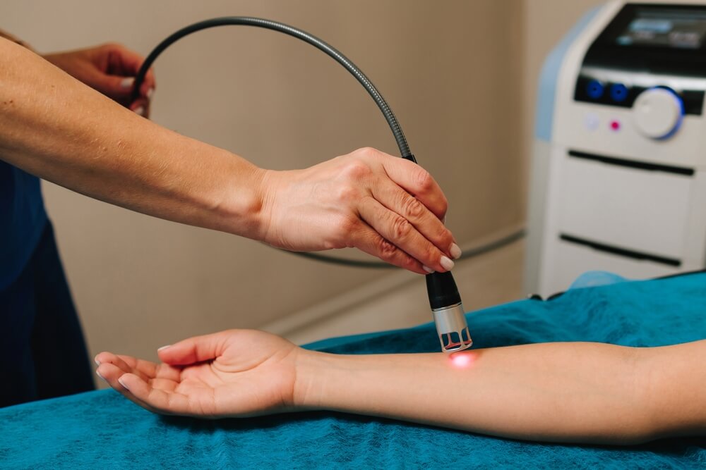 Cold Laser Therapy (LLLT)