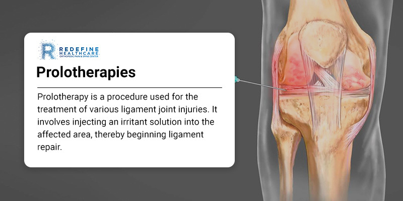 Prolotherapy